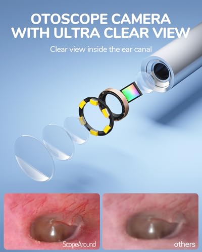 Otoscope Ear Camera with 4.5" IPS Screen, 1920x1080 FHD Smart Visual Ear Cleaner with Camera Tool Kit D1448