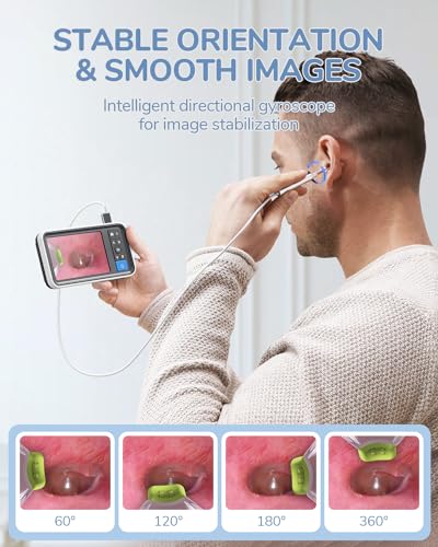 Otoscope Ear Camera with 4.5" IPS Screen, 1920x1080 FHD Smart Visual Ear Cleaner with Camera Tool Kit D1448