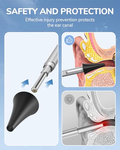 Otoscope Ear Camera with 4.5" IPS Screen, 1920x1080 FHD Smart Visual Ear Cleaner with Camera Tool Kit D1448